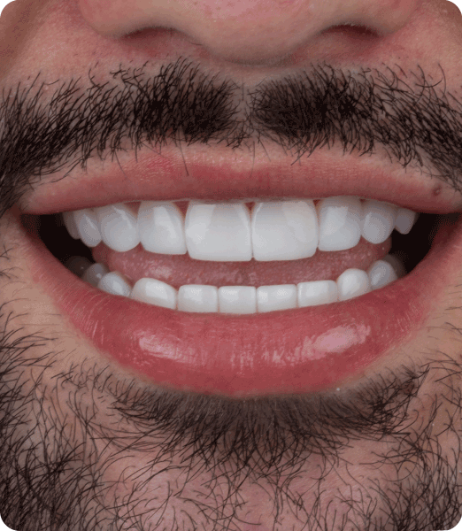 ANTES-Y-DESPUES-PAG2-2